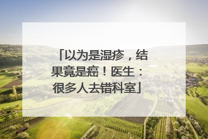 以为是湿疹，结果竟是癌！医生：很多人去错科室
